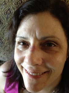 a close up of my face. Despite smiling, I have a black eye and a huge purple bruise on the bridge of my nose