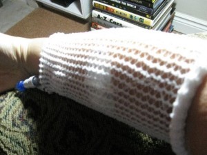 my forearm covered in gauze and a knit cozy with an IV line emerging near my wrist