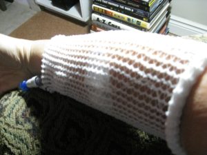 my arm with an IV in it, somewhat covered up by a netting sleeve