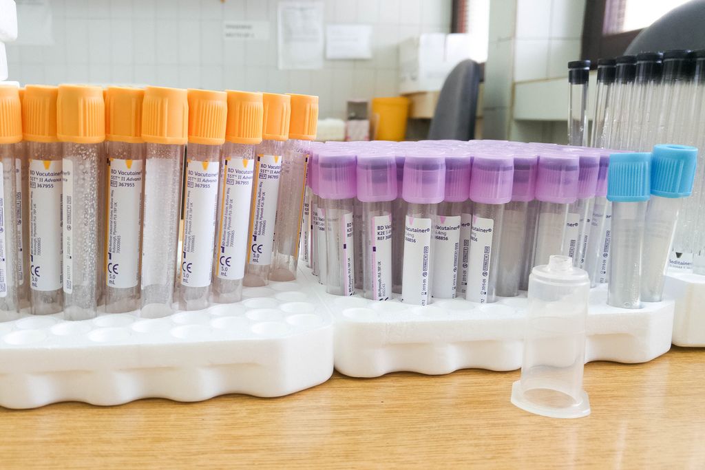 close up of test tubes at a medical lab