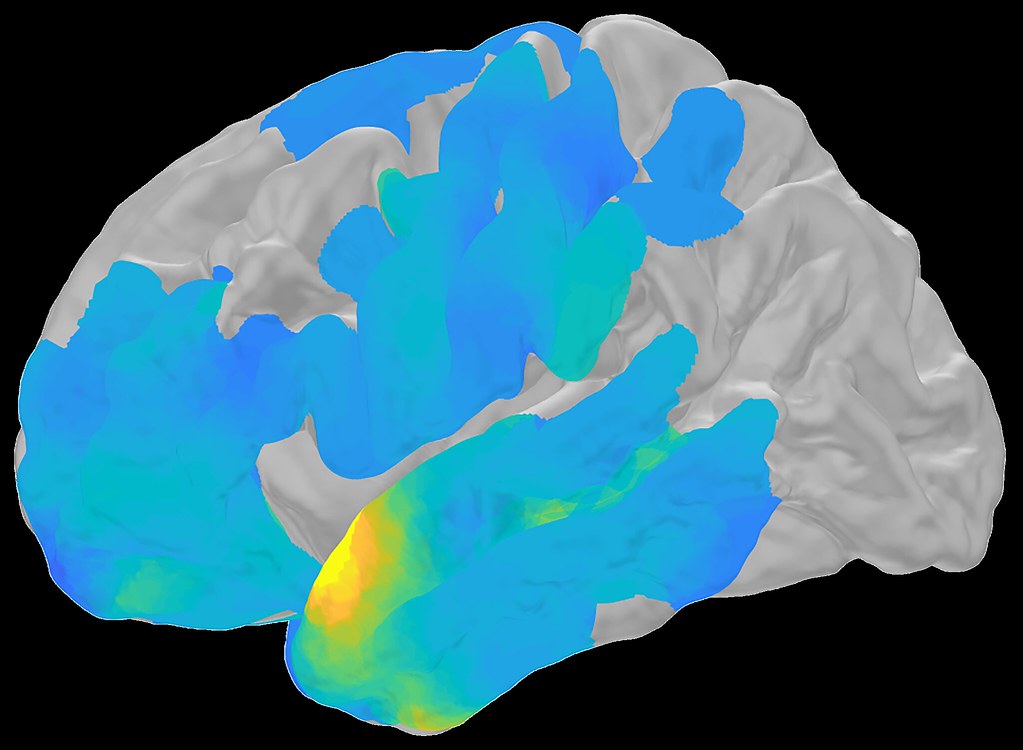 the brain with blue lights showing areas linked to memory